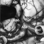 Figure 1 : Vue subfrontale / Subfrontal view